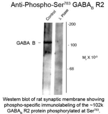 Western Blot: GABA-B R2 [p Ser783] Antibody [NB100-61101]